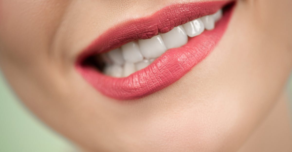 Close-up shot of woman's mouth wearing red lipstick, highlighting bright teeth and smooth skin.